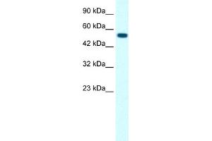 WB Suggested Anti-GLRA1 Antibody Titration:  0. (GLRA1 anticorps  (Middle Region))