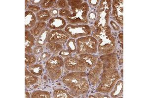 Immunohistochemical staining (Formalin-fixed paraffin-embedded sections) of human kidney with ART1 polyclonal antibody  shows strong cytoplasmic and membranous positivity in cells in tubules. (ART1 anticorps  (AA 37-122))