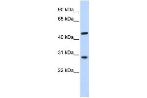 Western Blotting (WB) image for anti-Pygopus Homolog 2 (PYGO2) antibody (ABIN2459475) (PYGO2 anticorps)