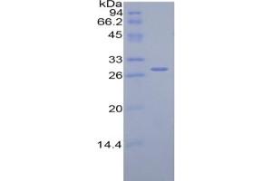 SDS-PAGE of Protein Standard from the Kit (Highly purified E. (Complement Factor H Kit ELISA)