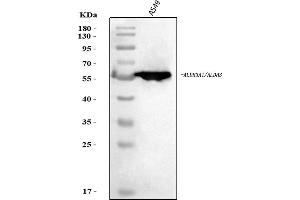 Western blot analysis of ALDH3A1 using anti-ALDH3A1 antibody (ABIN7602181).