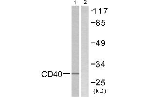 Immunohistochemistry analysis of paraffin-embedded human breast carcinoma tissue using CD40 antibody. (CD40 anticorps  (C-Term))