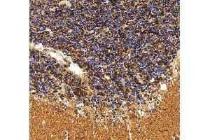 anti-Synaptogyrin 3 (SYNGR3) (AA 45-229) antibody