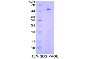SDS-PAGE of Protein Standard from the Kit (Highly purified E. (PCOLCE Kit ELISA)