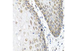 Immunohistochemistry of paraffin-embedded human esophagus using ANGPT1 antibody at dilution of 1:100 (40x lens). (Angiopoietin 1 anticorps)