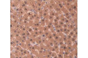 Used in DAB staining on fromalin fixed paraffin- embedded Kidney tissue (PIDD anticorps  (AA 668-917))