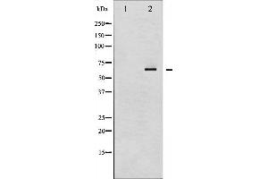 Western blot analysis of NF kappaB p65 phosphorylation expression in IL-1 treated Raw264. (NF-kB p65 anticorps  (pSer536))