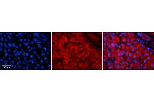 Rabbit Anti-GREB1 Antibody    Formalin Fixed Paraffin Embedded Tissue: Human Adult liver  Observed Staining: Cytoplasmic,Membrane Primary Antibody Concentration: 1:100 Secondary Antibody: Donkey anti-Rabbit-Cy2/3 Secondary Antibody Concentration: 1:200 Magnification: 20X Exposure Time: 0. (GREB1 anticorps  (N-Term))