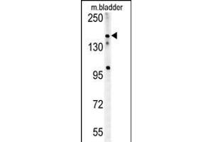 CASZ1 Antibody (C-term) (ABIN654196 and ABIN2844046) western blot analysis in mouse bladder tissue lysates (15 μg/lane). (CASZ1 anticorps  (C-Term))