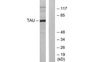 Western blot analysis of extracts from MDA-MB-435 cells, using Tau (Ab-231) Antibody. (tau anticorps  (AA 521-570))