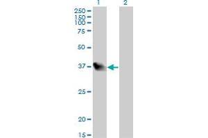 Western Blot analysis of LZTFL1 expression in transfected 293T cell line by LZTFL1 monoclonal antibody (M01), clone 7F6.