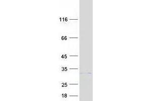 Validation with Western Blot