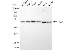 Western blotting analysis using RELA antibody (ABIN7799647).