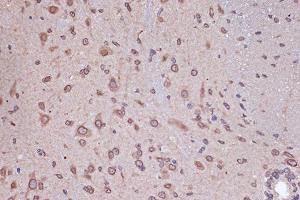 Immunohistochemistry of paraffin-embedded mouse spinal cord using RanG Rabbit mAb (ABIN7269846) at dilution of 1:100 (40x lens).