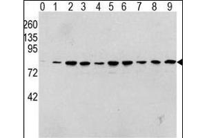 Western blot analysis of Phospho-RAF1-p Antibody in human T activated Hela cell line lysates. (RAF1 anticorps  (pSer338))