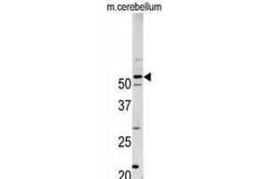 Western Blotting (WB) image for anti-Cyclin-Dependent Kinase 14 (CDK14) antibody (ABIN3003282) (CDK14 anticorps)