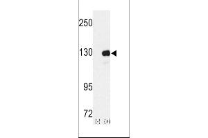 Western blot analysis of RENT1 using rabbit polyclonal RENT1 Antibody using 293 cell lysates (2 ug/lane) either nontransfected (Lane 1) or transiently transfected with the RENT1 gene (Lane 2). (RENT1/UPF1 anticorps  (N-Term))
