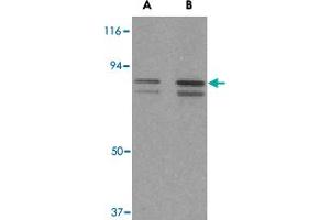 Western blot analysis of ATF6 in MCF-7 cell lysate with ATF6 polyclonal antibody  at (A) 0. (ATF6 anticorps  (C-Term))