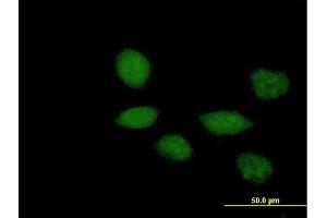 Immunofluorescence of purified MaxPab antibody to TWIST1 on HeLa cell. (TWIST1 anticorps  (AA 1-202))