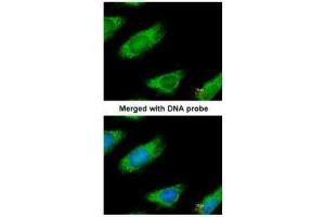 anti-Malic Enzyme 1, NADP(+)-Dependent, Cytosolic (ME1) antibody