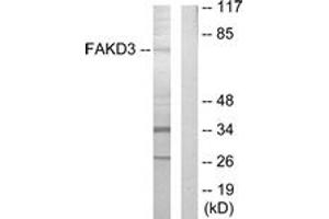 Western blot analysis of extracts from HepG2 cells, using FAKD3 Antibody.