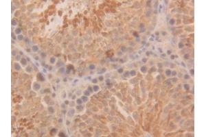 Used in DAB staining on fromalin fixed paraffin-embedded Kidney tissue