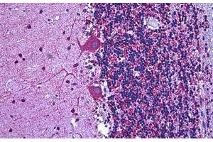 Human Brain Cerebellum: Formalin-Fixed, Paraffin-Embedded (FFPE) (Glutamic Acid Decarboxylase anticorps  (AA 545-594))