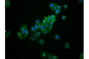 Immunofluorescence staining of HepG2 cells with ABIN7144643 at 1:133, counter-stained with DAPI. (AS3MT anticorps  (AA 262-375))