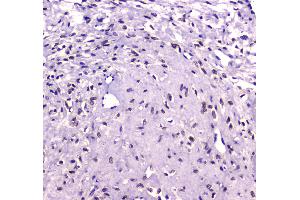 IHC analysis of RUNX1T1/ETO using anti-RUNX1T1/ETO antibody .