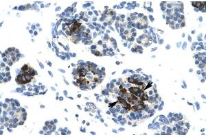 Human Pancreas (LIG4 anticorps  (N-Term))