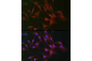 Immunofluorescence analysis of NIH/3T3 cells using IL6ST antibody (ABIN7268003) at dilution of 1:100.