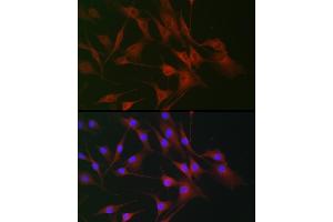 Immunofluorescence analysis of NIH/3T3 cells using IL6ST antibody (ABIN7268003) at dilution of 1:100. (CD130/gp130 anticorps  (AA 678-857))