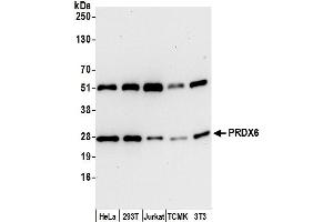 Western Blotting (WB) image for anti-Peroxiredoxin 6 (PRDX6) (AA 50-100) antibody (ABIN7450600)