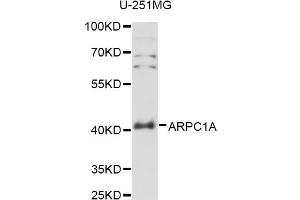 Western blot analysis of extracts of U-251MG cells, using ARPC1A antibody (ABIN6291261) at 1:3000 dilution. (ARPC1A anticorps)