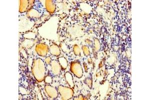 Immunohistochemistry of paraffin-embedded human thyroid tissue using ABIN7175061 at dilution of 1:100 (C5orf51 anticorps  (AA 8-152))