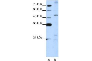 WB Suggested Anti-ZNF596 Antibody Titration:  5. (ZNF596 anticorps  (C-Term))
