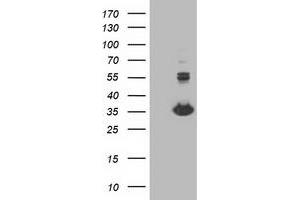 Western Blotting (WB) image for anti-Monoglyceride Lipase (MGLL) antibody (ABIN1499438)