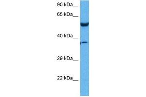Host:  Rabbit  Target Name:  P4HB  Sample Tissue:  Mouse Pancreas  Antibody Dilution:  1ug/ml (P4HB anticorps  (N-Term))