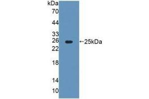 Detection of Recombinant AGXT, Rat using Polyclonal Antibody to Alanine Glyoxylate Aminotransferase (AGXT) (AGXT anticorps  (AA 182-371))