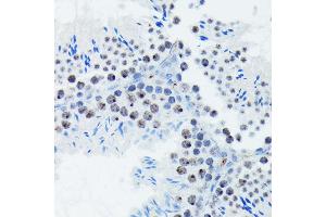 Immunohistochemistry of paraffin-embedded mouse testis using Phospho-p70 S6 Kinase 1-T421/S424 antibody (ABIN6135340, ABIN6136296, ABIN6136297 and ABIN7101878) at dilution of 1:100 (40x lens).