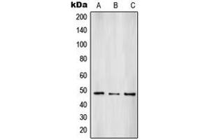 Western blot analysis of SUV39H2 expression in HepG2 (A), A431 (B), HL60 (C) whole cell lysates.