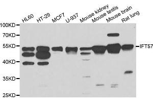 Western blot analysis of extracts of various cell lines, using IFT57 antibody. (IFT57 anticorps)