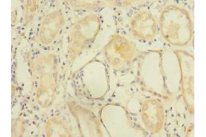 Immunohistochemistry of paraffin-embedded human kidney tissue using ABIN7162558 at dilution of 1:100 (ZDHHC6 anticorps  (AA 227-409))