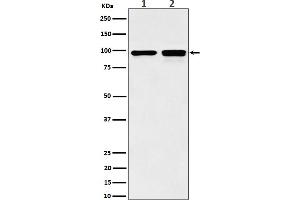 Western blot analysis of MCM6 expression in (1) MCF7 cell lysate, (2) NIH/3T3 cell lysate.