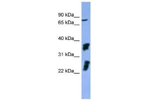 WB Suggested Anti-FGFR2 Antibody Titration: 0. (FGFR2 anticorps  (C-Term))