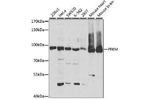 Western blot analysis of extracts of various cell lines, using PFKM antibody. (PFKM anticorps  (AA 501-780))