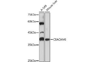 Western blot analysis of extracts of various cell lines, using CE Rabbit mAb (ABIN7266085) at 1:1000 dilution. (CEACAM6 anticorps)