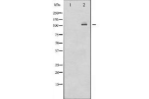 Western blot analysis of NF-kappaB p100/p52 expression in ovary cancer whole cell lysates,The lane on the left is treated with the antigen-specific peptide.