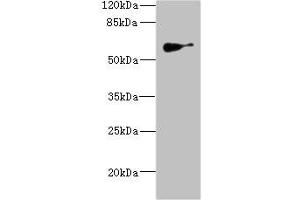 Western blot All lanes: SLC22A8antibody IgG at 1. (SLC22A8 anticorps  (AA 473-542))