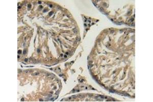 Figure. (GREM1 anticorps  (AA 26-184))